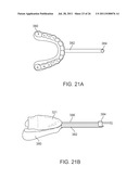 WEARABLE TISSUE RETENTION DEVICE diagram and image