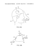 WEARABLE TISSUE RETENTION DEVICE diagram and image