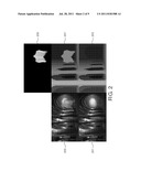 THREE DIMENSIONAL IMAGE DATA PROCESSING diagram and image