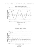 SEISMIC SYSTEM WITH GHOST AND MOTION REJECTION diagram and image