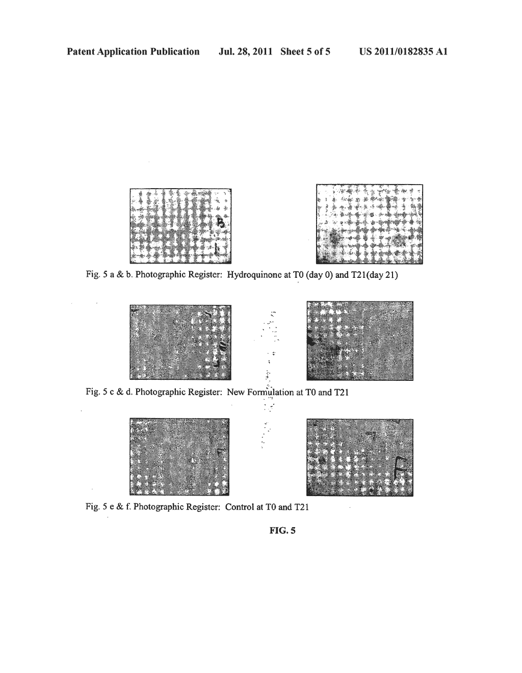 Topical Cosmetic Skin Lightening Compositions and Methods of use Thereof - diagram, schematic, and image 06