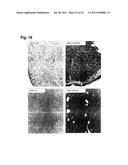 SIGNATURE AND DETERMINANTS ASSOCIATED WITH METASTASIS AND METHODS OF USE     THEREOF diagram and image