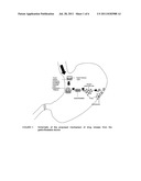 GASTRORETENTIVE PHARMACEUTICAL DOSAGE FORM diagram and image