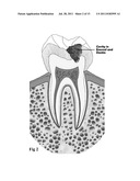 MEDICAL AND DENTAL BIOMATERIAL AND METHOD OF USE FOR THE SAME diagram and image