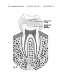 MEDICAL AND DENTAL BIOMATERIAL AND METHOD OF USE FOR THE SAME diagram and image