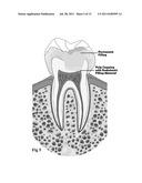 MEDICAL AND DENTAL BIOMATERIAL AND METHOD OF USE FOR THE SAME diagram and image