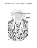 MEDICAL AND DENTAL BIOMATERIAL AND METHOD OF USE FOR THE SAME diagram and image