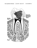 MEDICAL AND DENTAL BIOMATERIAL AND METHOD OF USE FOR THE SAME diagram and image