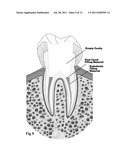 MEDICAL AND DENTAL BIOMATERIAL AND METHOD OF USE FOR THE SAME diagram and image