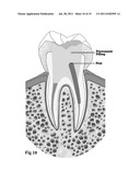 MEDICAL AND DENTAL BIOMATERIAL AND METHOD OF USE FOR THE SAME diagram and image