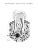 MEDICAL AND DENTAL BIOMATERIAL AND METHOD OF USE FOR THE SAME diagram and image