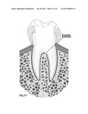 MEDICAL AND DENTAL BIOMATERIAL AND METHOD OF USE FOR THE SAME diagram and image