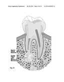 MEDICAL AND DENTAL BIOMATERIAL AND METHOD OF USE FOR THE SAME diagram and image