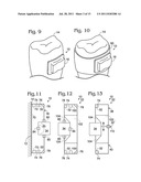 ORTHODONTIC APPLIANCE SYSTEMS diagram and image