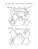 ORTHODONTIC APPLIANCE SYSTEMS diagram and image