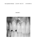 CERAMIC SURFACE COATINGS FOR DENTAL APPLICATIONS diagram and image