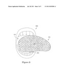 TONGUE RETRACTOR AND FLUID/PARTICLE BARRIER diagram and image