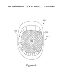 TONGUE RETRACTOR AND FLUID/PARTICLE BARRIER diagram and image