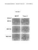 COMPOSITIONS AND METHODS FOR TREATING AND DIAGNOSING CANCER diagram and image