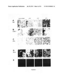 PTHrP, ITS ISOFORMS AND ANTAGONIST THERETO IN THE DIAGNOSIS AND TREATMENT     OF DISEASE diagram and image