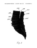 DEVICE AND METHOD FOR MINIMALLY INVASIVE SPINAL INTERVENTION diagram and image