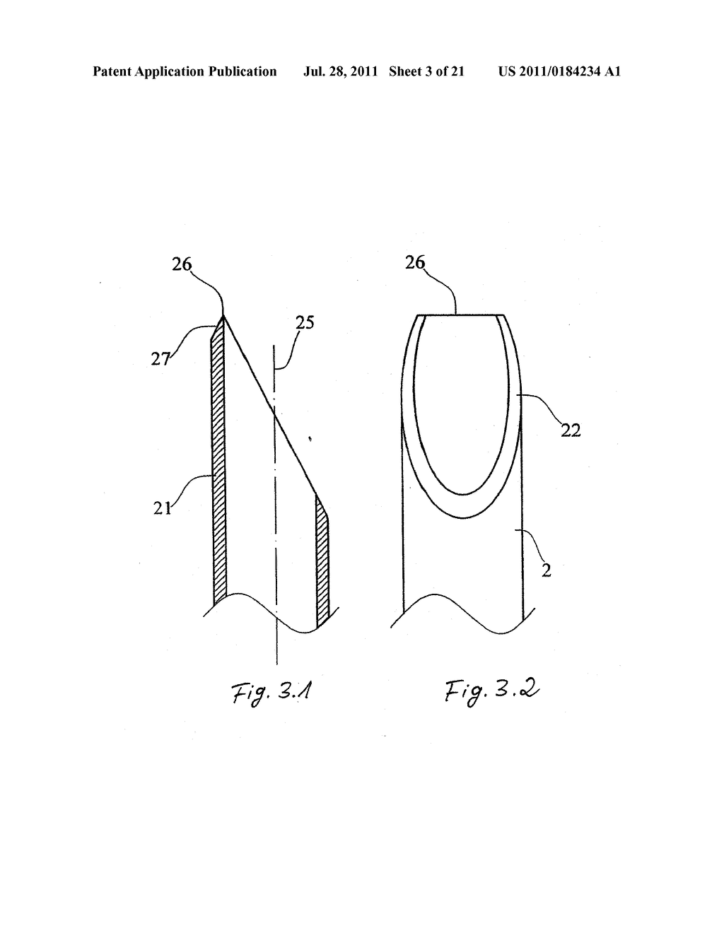 DEVICE AND METHOD FOR MINIMALLY INVASIVE SPINAL INTERVENTION - diagram, schematic, and image 04