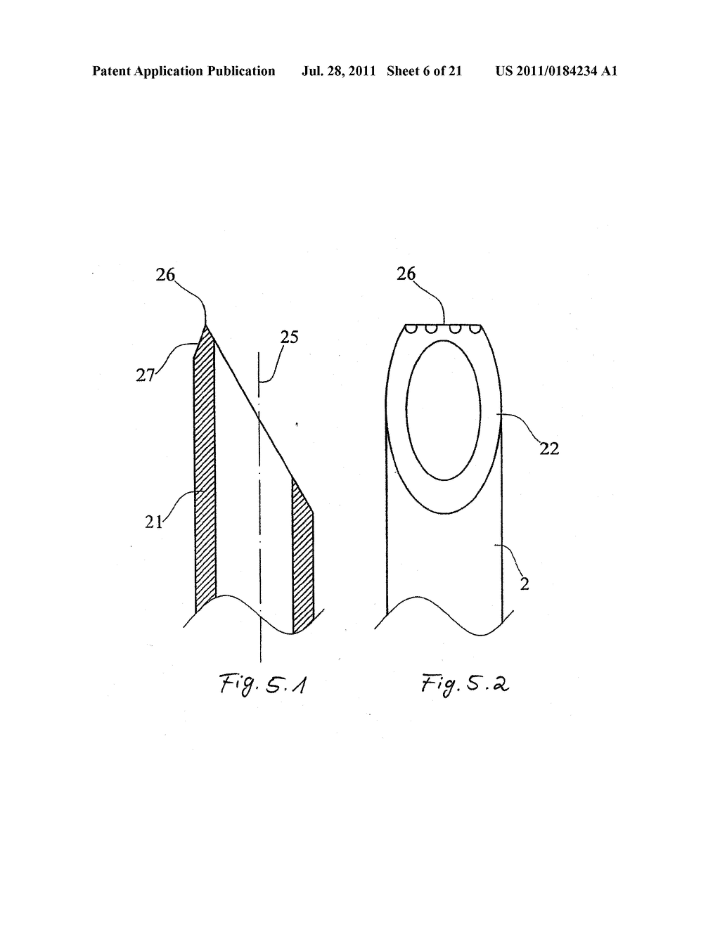 DEVICE AND METHOD FOR MINIMALLY INVASIVE SPINAL INTERVENTION - diagram, schematic, and image 07