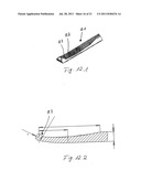 DEVICE AND METHOD FOR MINIMALLY INVASIVE SPINAL INTERVENTION diagram and image