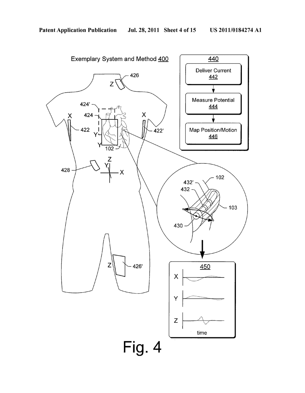 ELECTRODE CONFIGURATIONS FOR LEADS OR CATHETERS TO ENHANCE LOCALIZATION     USING A LOCALIZATION SYSTEM - diagram, schematic, and image 05