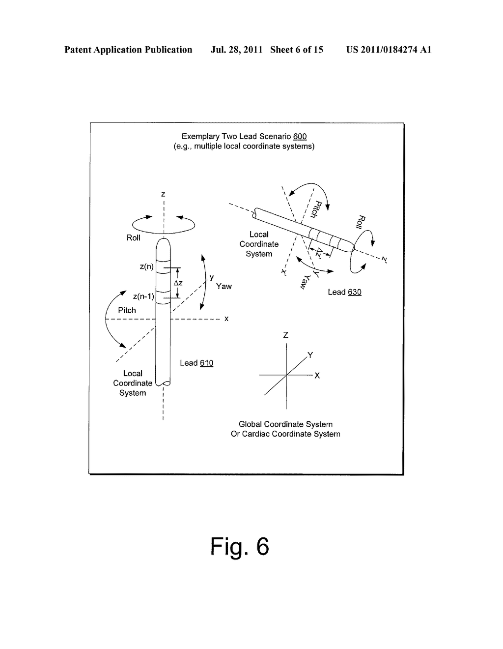 ELECTRODE CONFIGURATIONS FOR LEADS OR CATHETERS TO ENHANCE LOCALIZATION     USING A LOCALIZATION SYSTEM - diagram, schematic, and image 07