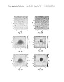 Methods And Systems For Spatially Modulated Ultrasound Radiation Force     Imaging diagram and image