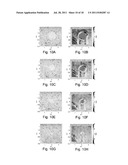 Methods And Systems For Spatially Modulated Ultrasound Radiation Force     Imaging diagram and image