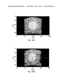 Methods And Systems For Spatially Modulated Ultrasound Radiation Force     Imaging diagram and image