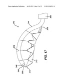 Tissue Retrieval Device with Resilient Member diagram and image