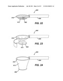 Tissue Retrieval Device with Resilient Member diagram and image