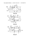 Methods and devices for denervation diagram and image