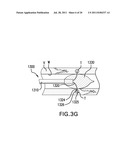 Methods and devices for denervation diagram and image