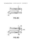 Methods and devices for denervation diagram and image