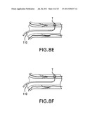 Methods and devices for denervation diagram and image