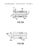 Methods and devices for denervation diagram and image