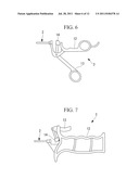 TREATMENT INSTRUMENT AND TREATMENT METHOD diagram and image