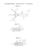 TREATMENT INSTRUMENT AND TREATMENT METHOD diagram and image