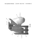 Instrumentation for Implants with Transition Surfaces and Related     Processes diagram and image