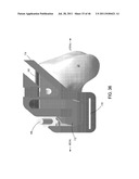 Instrumentation for Implants with Transition Surfaces and Related     Processes diagram and image