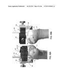 Instrumentation for Implants with Transition Surfaces and Related     Processes diagram and image