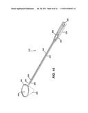 Tissue Retrieval Device with Pouch Stretching Arm diagram and image