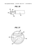 Method of Fitting Pouch in Tissue Retrieval Device diagram and image