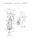 SUTURE MANAGEMENT AND TENSIONING DEVICES AND METHODS FOR SOFT TISSUE     RECONSTRUCTION OR BONE-TO-BONE FIXATION diagram and image