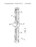 SUTURE MANAGEMENT AND TENSIONING DEVICES AND METHODS FOR SOFT TISSUE     RECONSTRUCTION OR BONE-TO-BONE FIXATION diagram and image