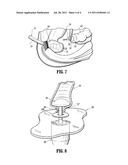 ANASTOMOSIS COMPOSITE GASKET diagram and image